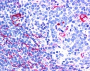 PAB6510 - NET1