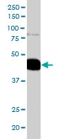 PAB6527 - Pleckstrin / PLEK