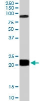 PAB6531 - RASAL1