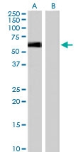 PAB6532 - Syntrophin-1 / SNTA1