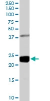 PAB6538 - GIPC1