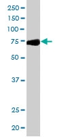 PAB6540 - NUP85 / NUP75 / PCNT1
