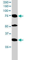 PAB6545 - LMO7