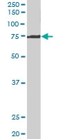 PAB6551 - MPP5