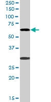 PAB6552 - MPP6