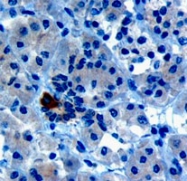 PAB6553 - PARD6A