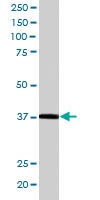 PAB6554 - PDLIM1