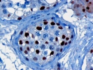 PAB6561 - KPNA4 / Importin alpha-4