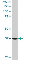 PAB6569 - PDLIM4