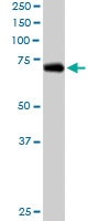 PAB6571 - RanGAP1
