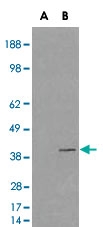 PAB6573 - VPS26A