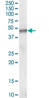 PAB6579 - STK35