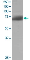 PAB6583 - SH3BP1