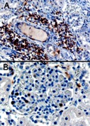 PAB6583 - SH3BP1