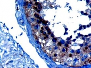 PAB6584 - VPS28