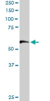 PAB6585 - CCT1 / TCP1