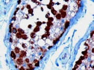 PAB6585 - CCT1 / TCP1