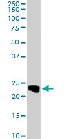 PAB6587 - Transgelin (TAGLN)