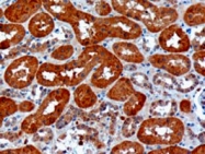 PAB6589 - USH1C / Harmonin