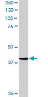 PAB6590 - SIRT4