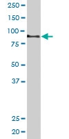 PAB6598 - AKAP3