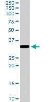 PAB6603 - VDAC2