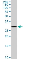 PAB6607 - MPG / ANPG
