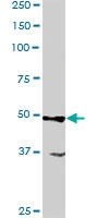 PAB6615 - ACTL6A/ACTL6B