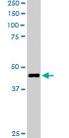 PAB6618 - Centractin beta