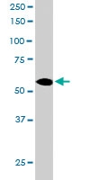 PAB6623 - Coronin-1C