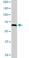 PAB6630 - RGS14