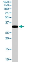 PAB6639 - MCL1