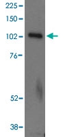 PAB6640 - UNC13D