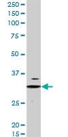 PAB6643 - LIME1