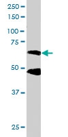 PAB6644 - CPEB1