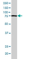 PAB6649 - LCP2