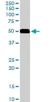PAB6651 - CD2BP2