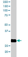 PAB6654 - RANBP1