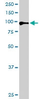 PAB6663 - Androgen receptor