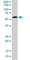 PAB6665 - 58K Golgi Protein