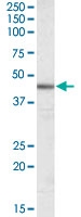 PAB6668 - ACTA2 / aortic smooth muscle Actin