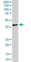 PAB6672 - Dickkopf-1