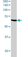 PAB6677 - Anthrax toxin receptor 1 / ANTXR1