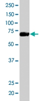PAB6683 - Formin-binding protein 1