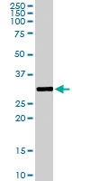 PAB6686 - FHL1