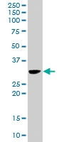 PAB6687 - FHL1