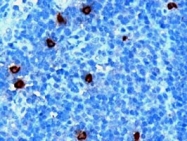 PAB6689 - DOK5