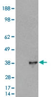 PAB6689 - DOK5