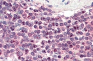 PAB6690 - NR1H2