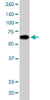 PAB6691 - NR1H3